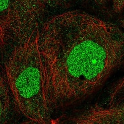 ZNF791 Antibody, Novus Biologicals:Antibodies:Primary Antibodies
